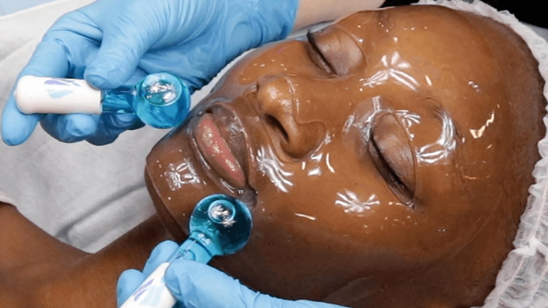 Facial treatment with suction cups on a smiling woman.
